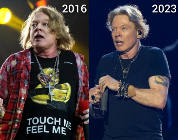 Axl Rose’s Transformation: A Journey of Weight Loss and Renewed Energy